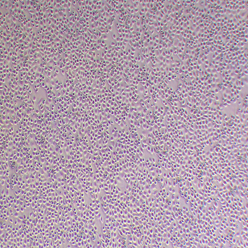 HL-7702人肝细胞（Hela污染细胞系）