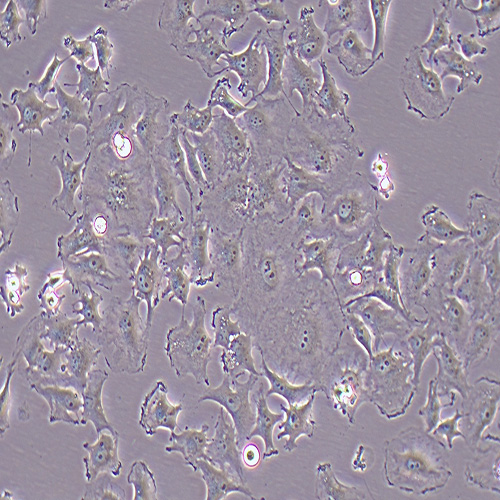 HS578T人乳腺癌细胞