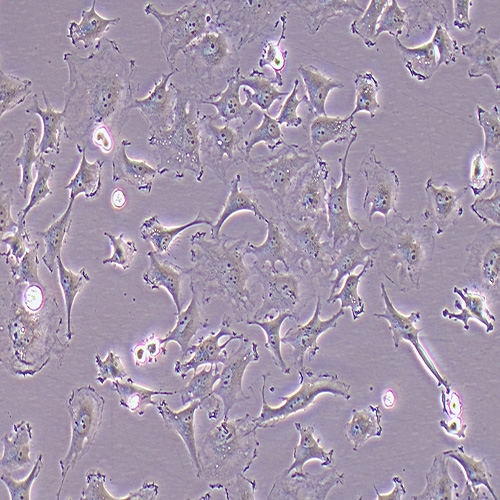 HS578T人乳腺癌细胞