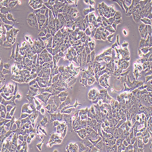 MCF-7人乳腺癌细胞（STR鉴定正确）