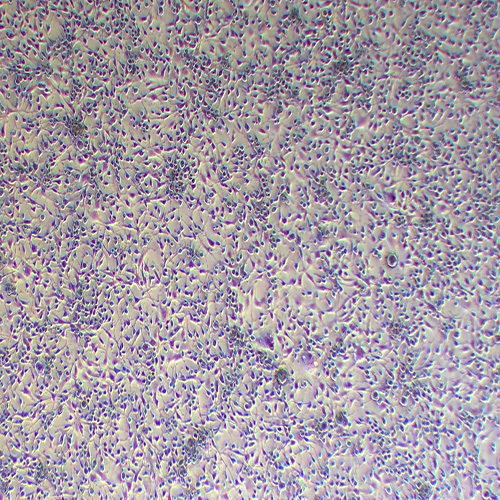 MDA-MB-436人乳腺癌细胞（STR鉴定正确）