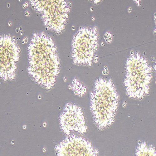 MT-4人急性淋巴母细胞白血病细胞（STR鉴定正确）