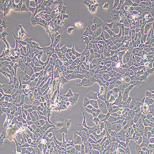 NCI-H322人支气管肺泡癌细胞