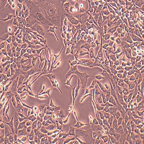 NCI-H2009人肺腺癌细胞（STR鉴定正确）