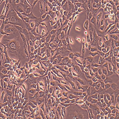 NCI-H2009人肺腺癌细胞（STR鉴定正确）