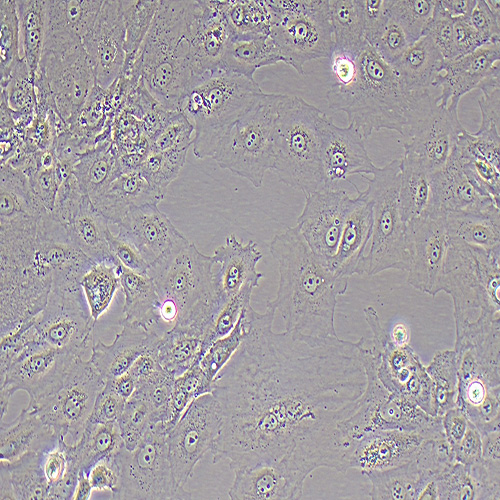 SNU-182人肝癌细胞（STR鉴定正确）