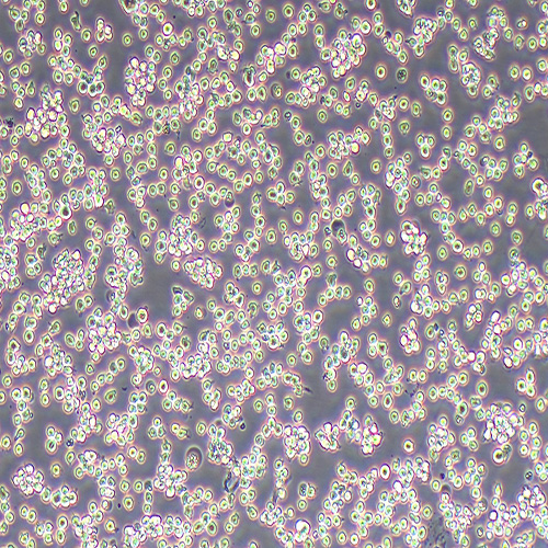 SU-DHL-6人大细胞淋巴瘤细胞
