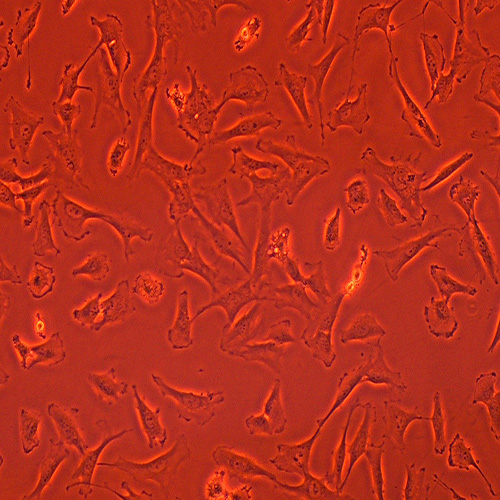 SW579人甲状腺鳞癌细胞（STR鉴定正确）