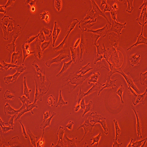 SW579人甲状腺鳞癌细胞（STR鉴定正确）