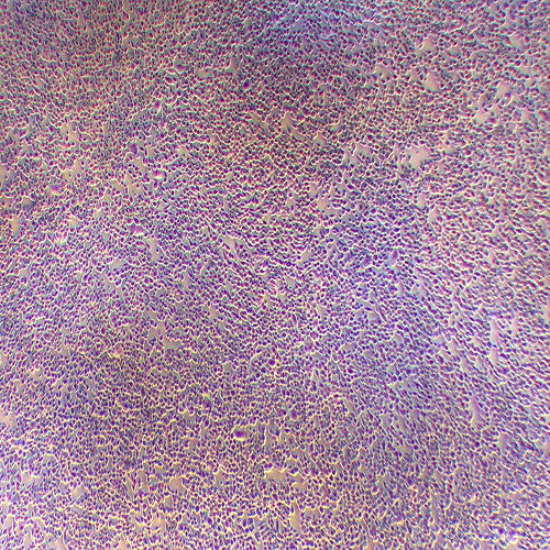 SW620人结直肠腺癌细胞（STR鉴定正确）