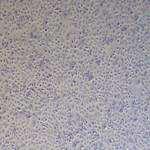TE-1人食管癌细胞（STR鉴定正确）
