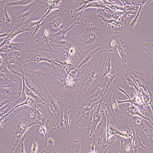 U-87 MG人脑星形胶质母细胞瘤细胞（STR鉴定正确）