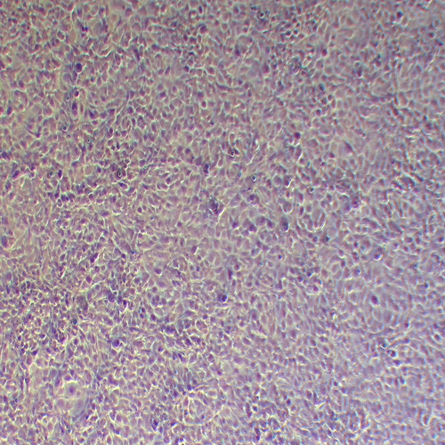 786-O-LUC(人肾透明细胞腺癌细胞-荧光素酶标记（STR鉴定正确）)