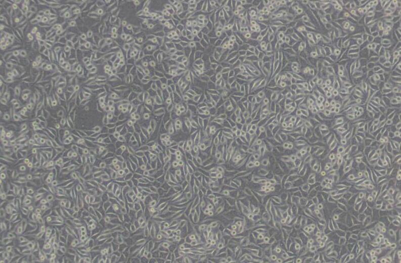 NCTC clone 929 [L cell, L-929]（小鼠成纤维细胞）