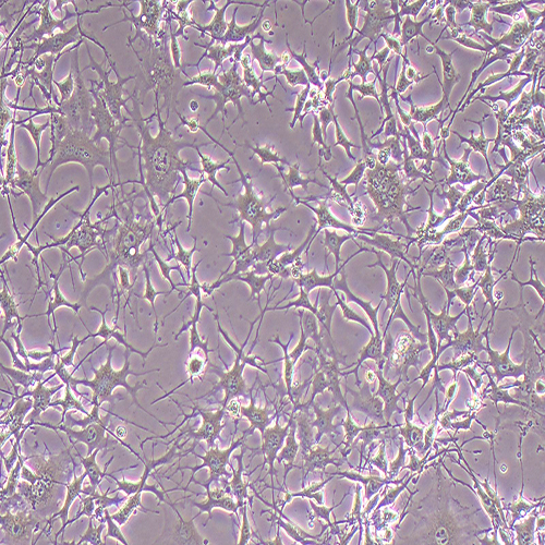 K7M2-WT-GFP（小鼠骨肉瘤成骨细胞-绿色荧光蛋白标记）