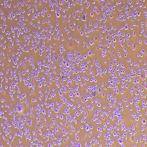 K7M2-WT-GFP（小鼠骨肉瘤成骨细胞-绿色荧光蛋白标记）