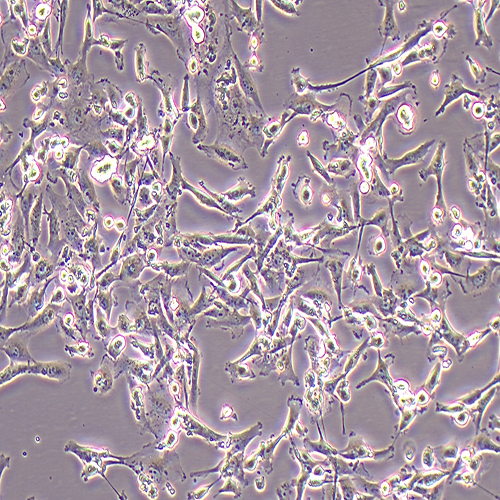 MDA-MB-231-LUC（人三阴性乳腺癌细胞-荧光素酶标记（STR鉴定正确））