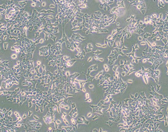 P19 [P-19]（小鼠畸胎瘤细胞）