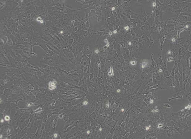 RF/6A（猴脉络膜-视网膜内皮细胞）