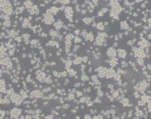 YAC-1（小鼠淋巴瘤细胞）