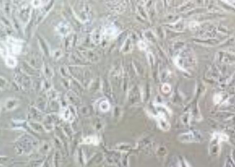 GH3（大鼠垂体瘤细胞）