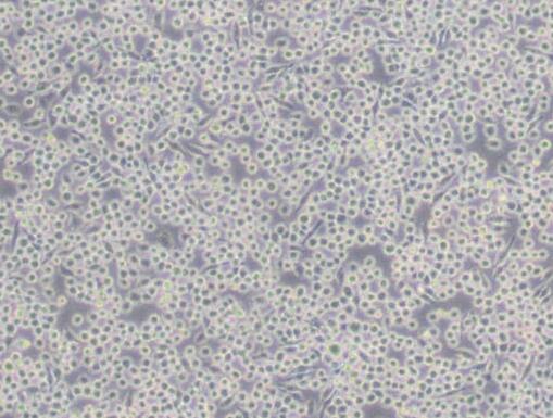 J774A.1（小鼠单核巨噬细胞）