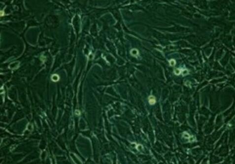 KP-N-NS（人肾上腺神经母细胞瘤细胞(脑转移)）