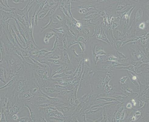 SW 1353 (人软骨肉瘤细胞) （L15）