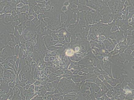 SW 1990 (人胰腺癌细胞)（L15）