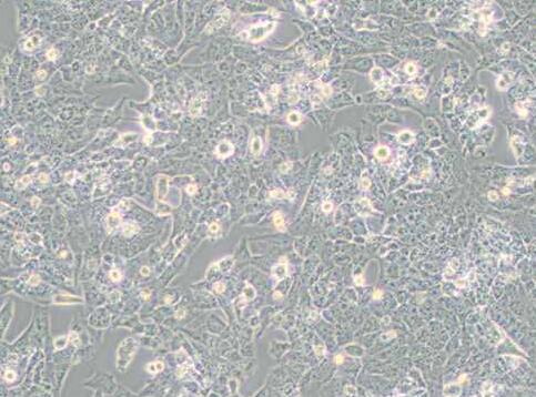 UMR-106（大鼠骨肉瘤细胞）