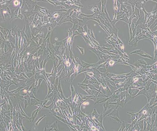 BALB/3T3 clone A31（小鼠胚胎成纤维细胞）
