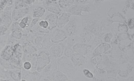 SCC-25 [SCC 25; SCC25]（人舌磷癌细胞）
