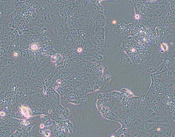 HPAF-II（人胰腺癌细胞）