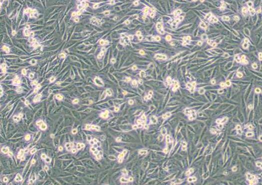 MDA-MB-231/GFP (人乳腺癌细胞(绿色荧光蛋白标记) (L15) 