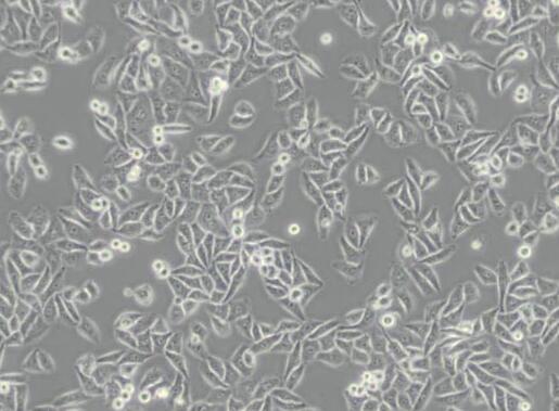 SK-OV-3 (人卵巢癌细胞)