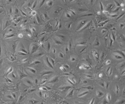鸡卵泡基膜细胞