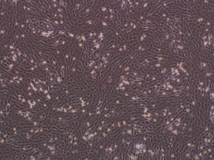 人胎盘绒毛膜滋养层细胞