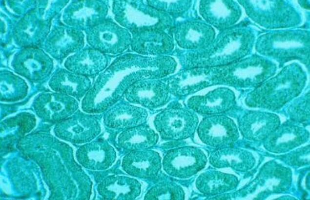 人胰腺癌组织源细胞