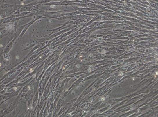 人脐带血间充质干细胞