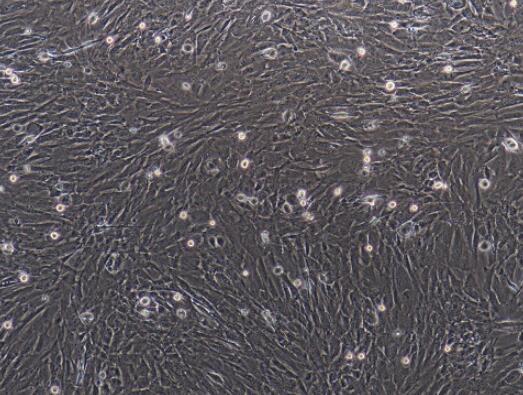 小鼠气管平滑肌细胞