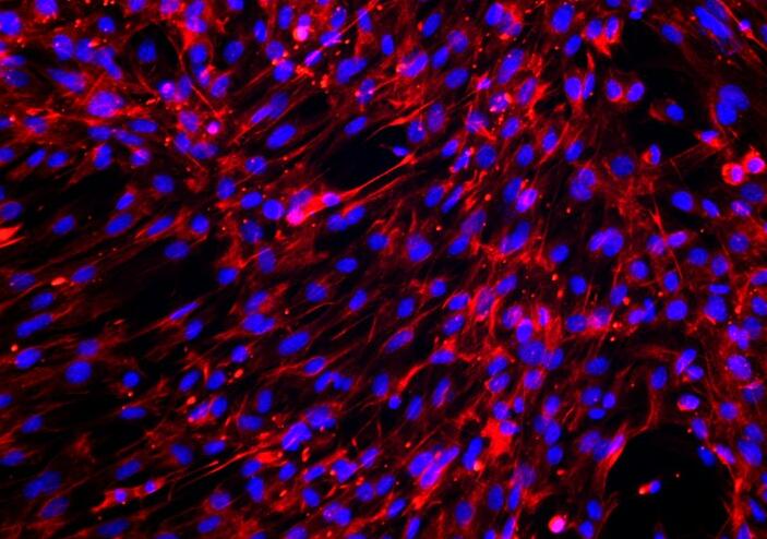 小鼠肺成纤维细胞