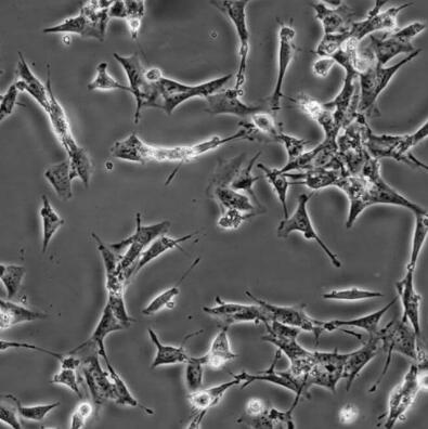 小鼠肾小球系膜细胞