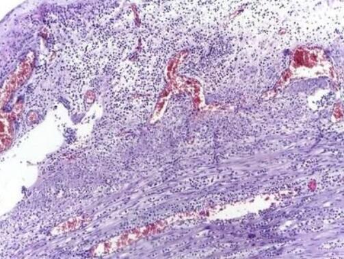 小鼠外周血中性粒细胞