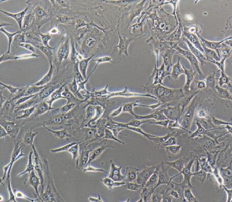 小鼠胚肺成纤维细胞