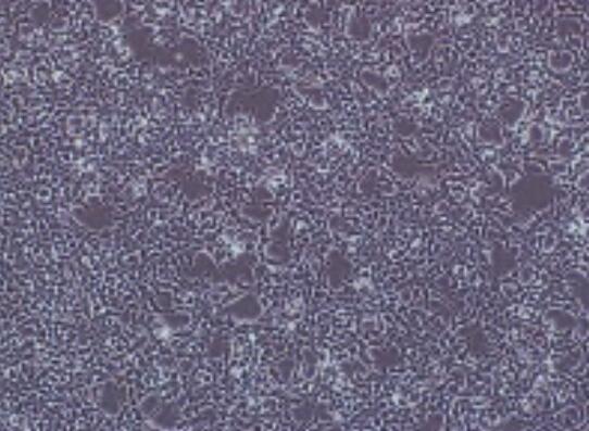 小鼠前列腺成纤维细胞