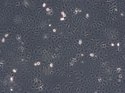小鼠子宫内膜基质细胞