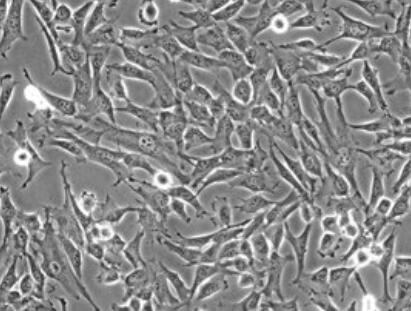 大鼠骨髓基质细胞