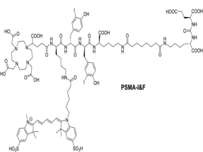 PSMA I＆F