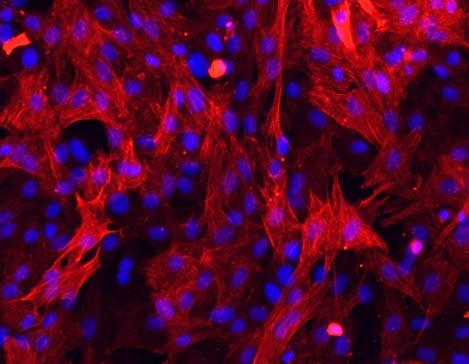 大鼠血管外膜成纤维细胞