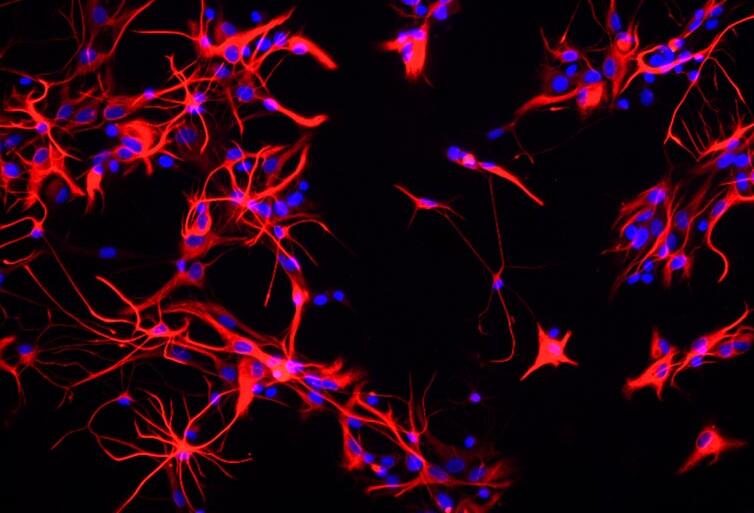大鼠神经星形胶质细胞